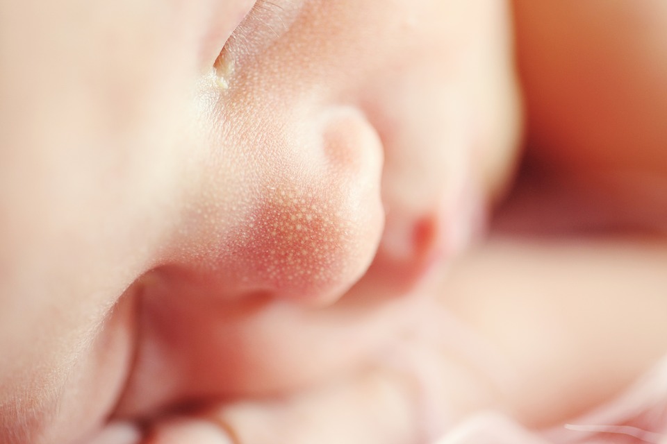 symptoms and treatment for blocked tear duct in new born babies